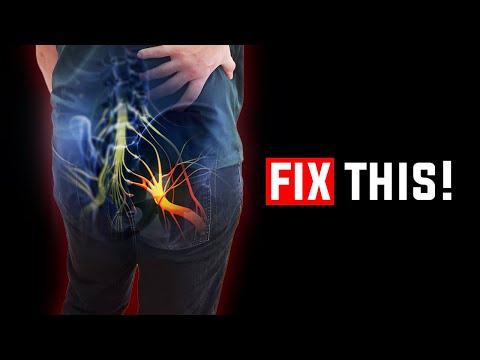 Видео: Лучшее упражнение при ишиасе, грушевидной мышце и напряженных ягодицах!