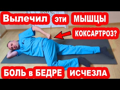 Видео: Боль в Наружной части БЕДРА - это НЕ тазобедренный Сустав! Вылечи эти Мышцы и Боль УЙДЕТ!