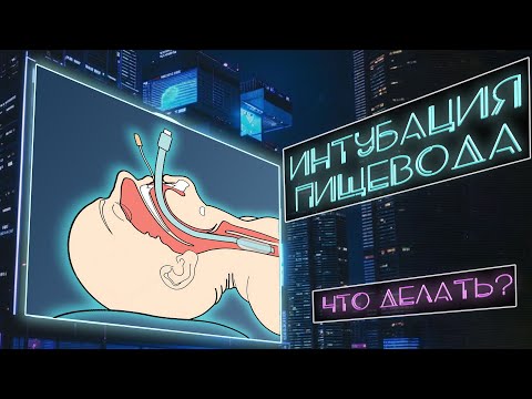 Видео: Интубация пищевода. Что делать? Надо ли вынимать ЭТТ? #ПроСМП