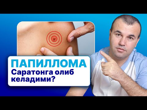 Видео: Папиллома ва Сўгаллар — Саратонга олиб келадими? | 90 788 83 13