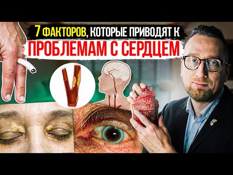 Видео: Как понять, что есть ПРОБЛЕМЫ с СЕРДЦЕМ без похода к врачу?