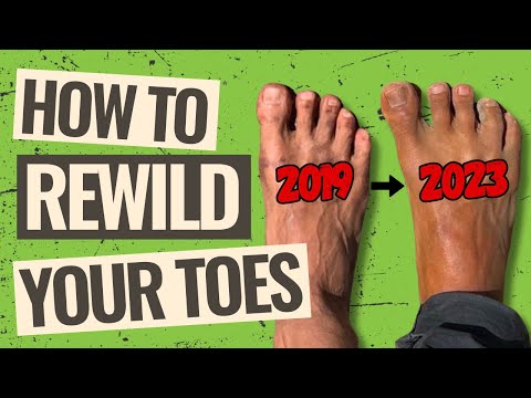 Видео: Как вернуть форму пальцам ног | Восстановить естественную форму пальцев ног