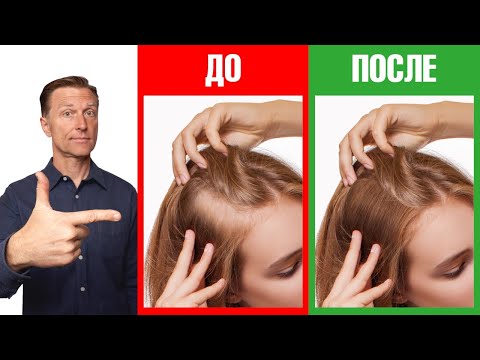 Видео: Как сделать волосы гуще? Простые советы👌