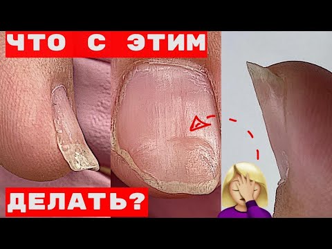 Видео: Ужасные ТРАМПЛИНЫ 😱 Пропилы / Разорванная кутикула / Маникюр