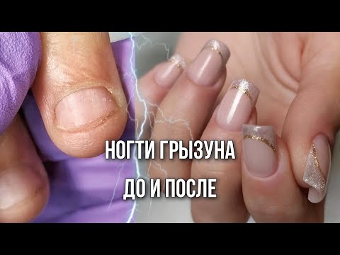 Видео: Съеденные ногти. Наращивание на сложных руках. Ногти грызуна.
