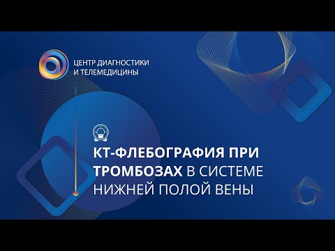 Видео: КТ-флебография при тромбозах в системе нижней полой вены