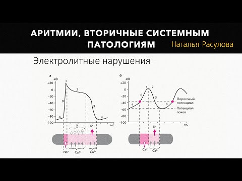 Видео: Аритмии, вторичные системным патологиям