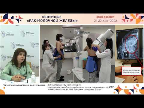 Видео: Рак молочной железы на фоне беременности: стандартизация лечебных подходов. Пароконная А. А.