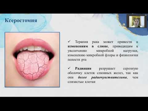 Видео: Оральный мукозит