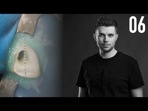 Видео: Почему ломаются инструменты? Серия 1: торсионная нагрузка