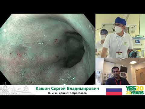 Видео: 18. Длинный сегмент ПБ. Диагностика и лечение (РЧА). С. В. Кашин, К. В.  Шишин