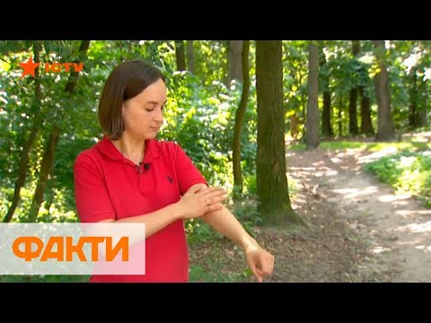 Видео: Укусы насекомых: чем опасны, лечение и как защититься