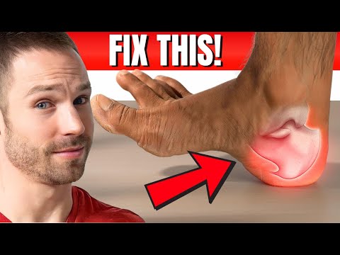 Видео: Как на самом деле вылечить подошвенный фасциит (согласно исследованиям)