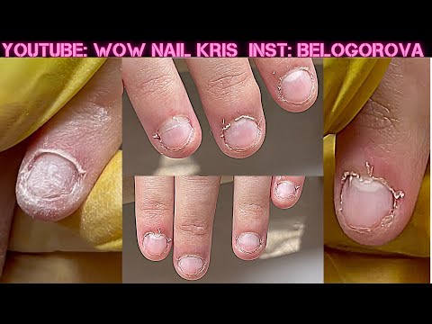 Видео: Разрывы| Заусенцы| Сложнейшая кутикула| Накосячила🤷🏻‍♀️