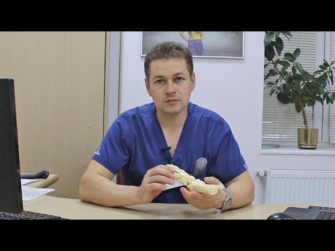 Видео: Лечение приведения переднего отдела стопы.