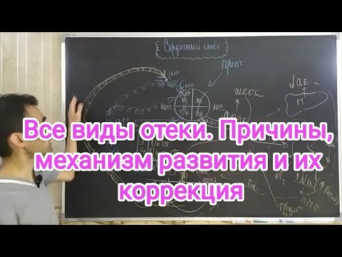 Видео: Отеки. edema