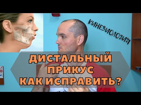 Видео: Дистальный прикус и его коррекция. Неправильный прикус
