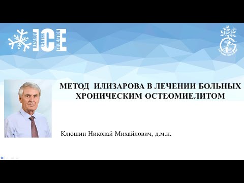 Видео: Метод Илизарова в лечении больных хроническим остеомиелитом