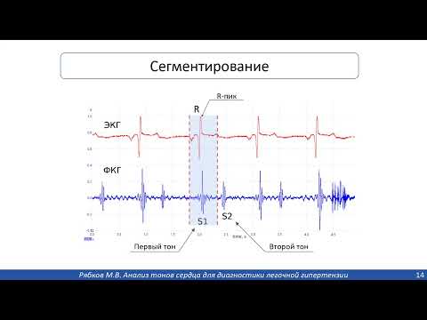 Видео: Примеры решения задач с применением ИИ
