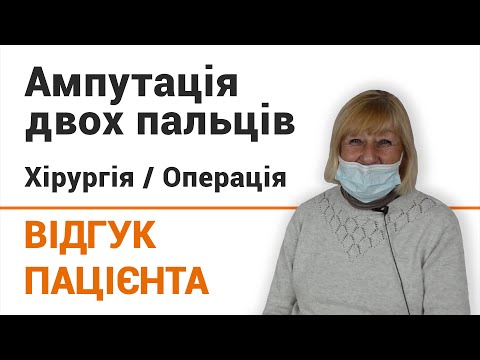 Видео: Ампутация двух пальцев - отзыв пациентки о хирургическом лечении в клинике "Добрый прогноз"