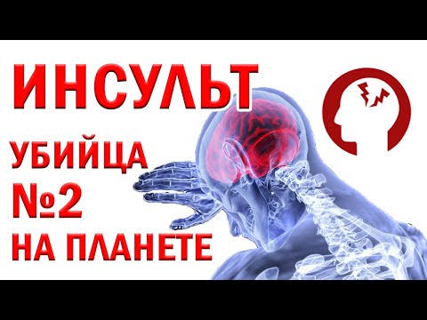 Видео: ИНСУЛЬТ - первая помощь, реабилитация, профилактика. Стресс, холестерин, бляшки, ПП. О самом главном