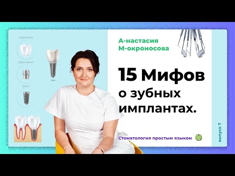 Видео: Импланты зубов! | Самые популярные мифы про имплантацию зубов