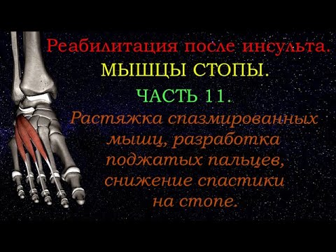 Видео: Растяжка спазмированных мышц, снятие тонуса. Часть 11. Мышцы стопы.