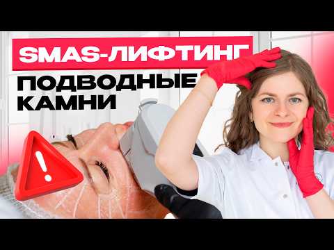 Видео: SMAS лифтинг “подводные камни” в работе косметолога