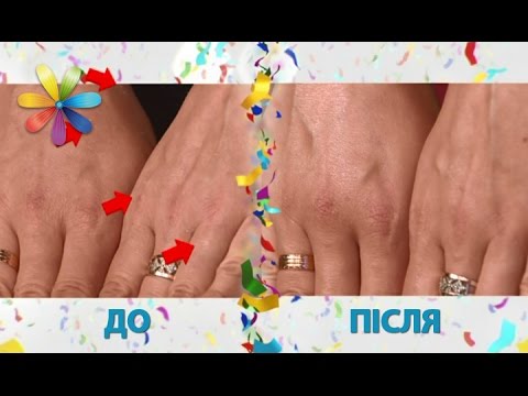 Видео: Ванночка для рук от сухости и шелушения – Все буде добре. Выпуск 980 от 09.03.17