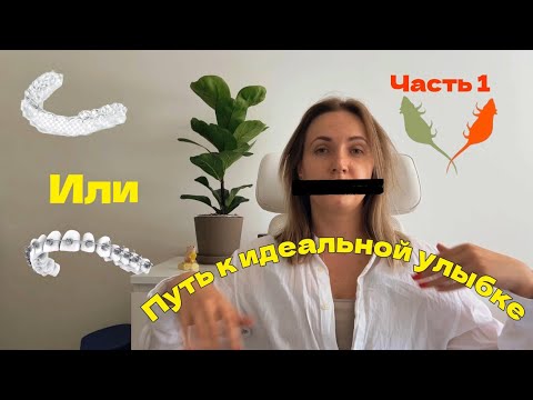 Видео: МОЙ ПУТЬ К ИДЕАЛЬНОЙ УЛЫБКЕ | ЧЕК ЛИСТ ПО ВЫБОРУ СТОМАТОЛОГА |БРЕКЕТЫ ИЛИ ЭЛАЙНЕРЫ | МОЯ ИСТОРИЯ