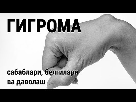 Видео: Гигрома. Сабаблари, белгилари ва даволаш.
