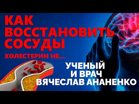 Видео: Это ПРАВИЛО ДЛЯ ВСЕХ! Вся правда о Холестерине и атеросклерозе
