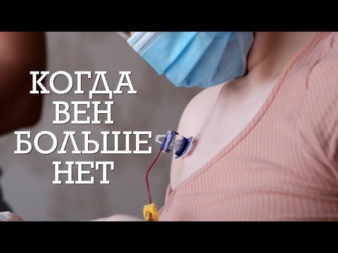 Видео: Порт. Центральный катетер. Portacath