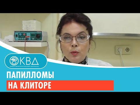 Видео: 👩 1486  Папилломы на клиторе