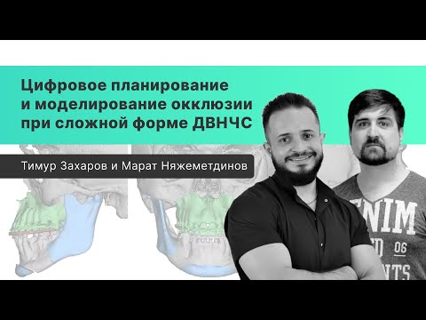 Видео: Цифровое планирование и моделирование окклюзии при сложной форме ДВНЧС - вебинар с экспертами