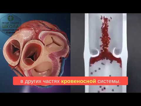 Видео: Скандинавская ходьба и сердце.