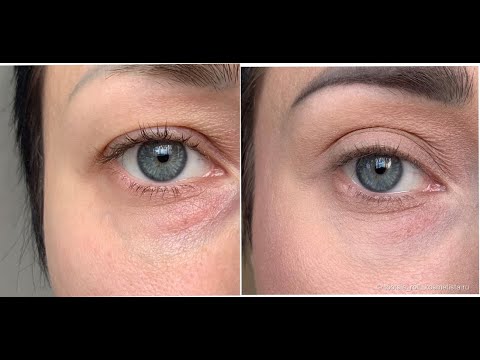 Видео: Нависающее веко и морщины на лбу. Упражнения от опущенного верхнего века и морщин на лбу.