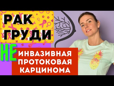 Видео: Рак молочной железы. НЕинвазивная протоковая карцинома "in situ". DCIS /CCIS. Диагностика. Лечение.