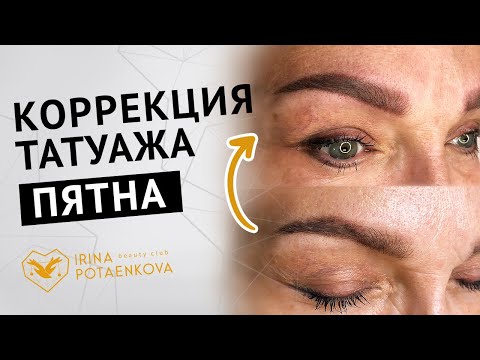 Видео: Коррекция татуажа бровей. 😱Татуаж зажил пятнами, как исправить?
