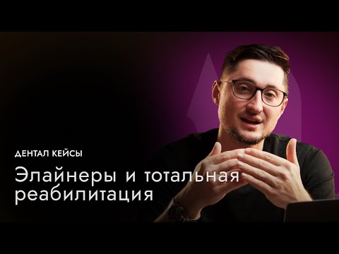 Видео: Тотальная реабилитация | Виниры, Коронки, Элайнеры | Артур Лукьяненко