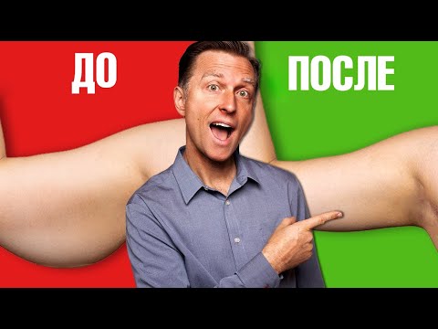 Видео: ТОЛЬКО ТАК вы подтянете обвисшую и дряблую кожи на руках!👍