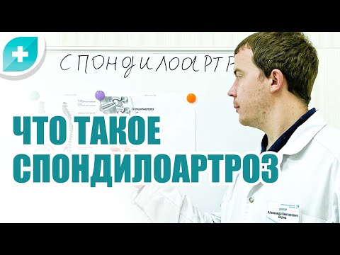 Видео: Что такое  спондилоартроз и как его лечить