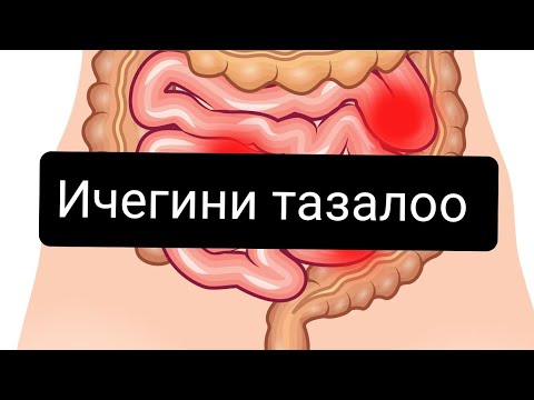 Видео: ДЕТОКС l ИЧЕГИЛЕРДИ ТАЗАЛОО l ИЧЕГИНИ БИР ЭЛЕ ЖОЛУ ТАЗАЛАҢЫЗ