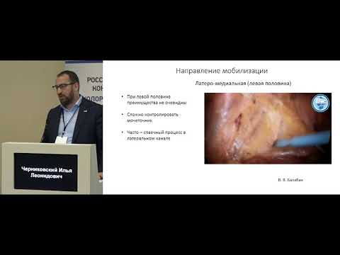 Видео: Стандартизация лапароскопической хирургии колоректального рака. И.Л.Черниковский