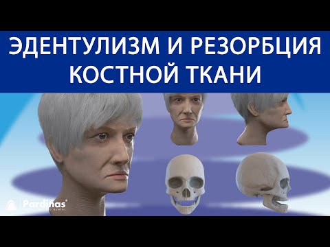 Видео: Эдентулизм и резорбция костной ткани ©