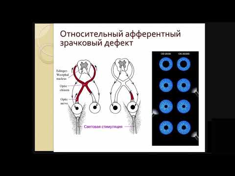 Видео: Современные методы диагностики нейроофтальмологической патологии