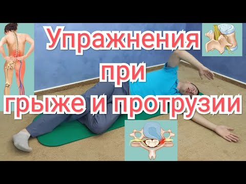 Видео: Комплекс упражнений для лечения межпозвоночной грыжи поясничного отдела позвоночника.