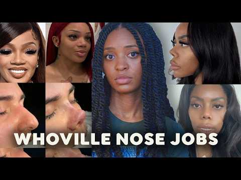 Видео: Этика этнической ринопластики