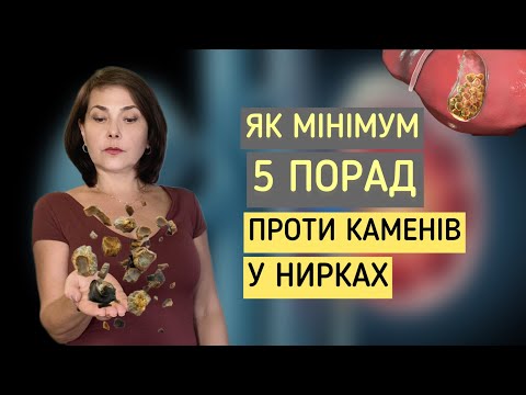 Видео: Як мінімум 5 порад проти КАМЕНІВ У НИРКАХ! / Dr. Ruslana Borysenko