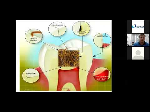 Видео: Вебинар на русском-Григорьев Александр- Мифы адгезивной стоматологии,в прямой и непрямой реставрации